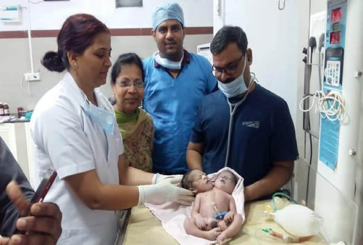 madhya pradesh woman gives birth to boy with 2 heads, 3 hands, 4 feet