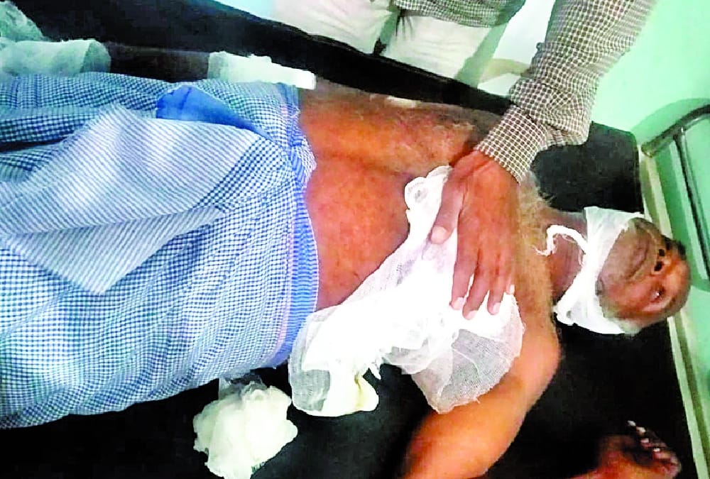 Eight injured in wild pig attack in Ambedkarnagar.