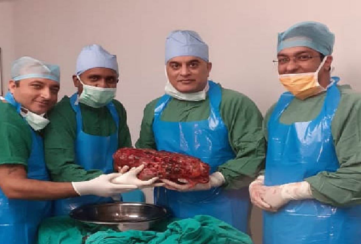 sir ganga ram hospital doctors operated took out worlds third heaviest kidney