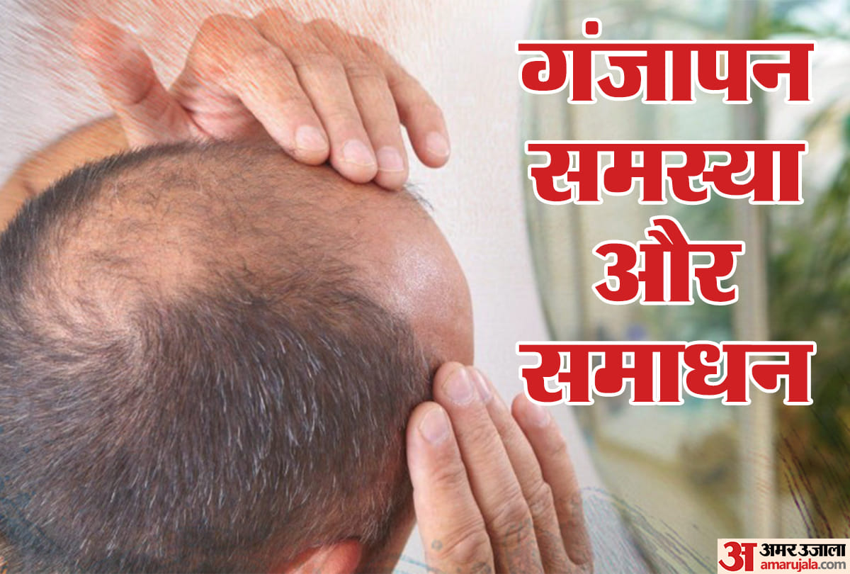 Hair Transplant