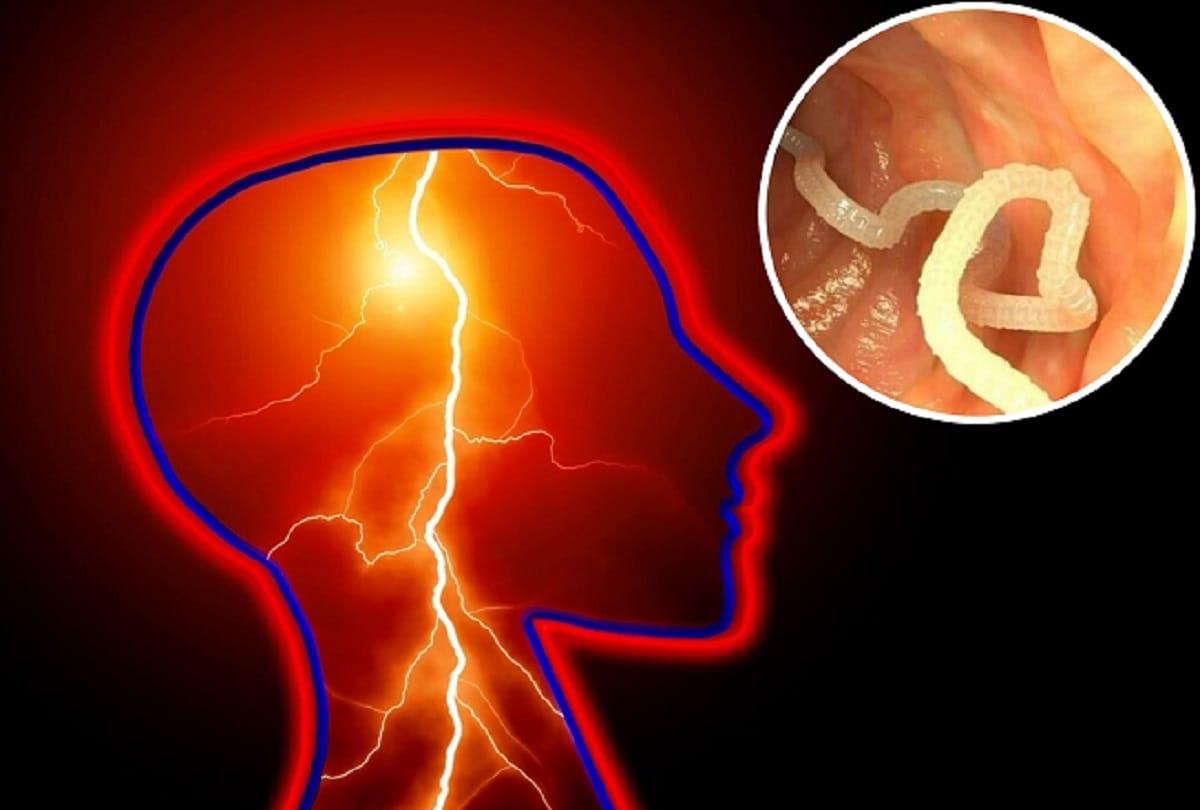 Doctors found more than 700 tapeworms in body of a man in china