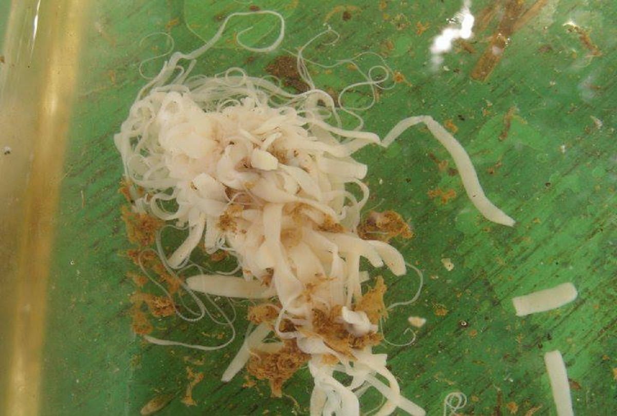 Doctors found more than 700 tapeworms in body of a man in china