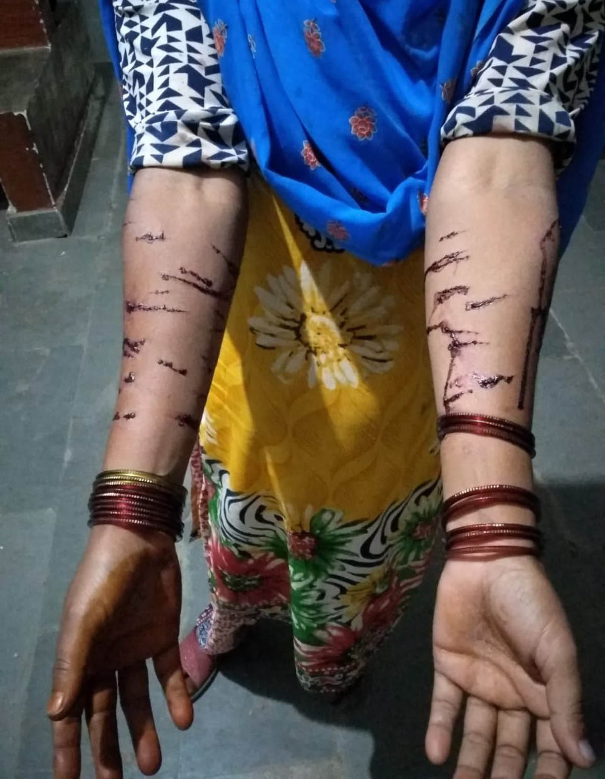 Wife attacked with knives for divorce