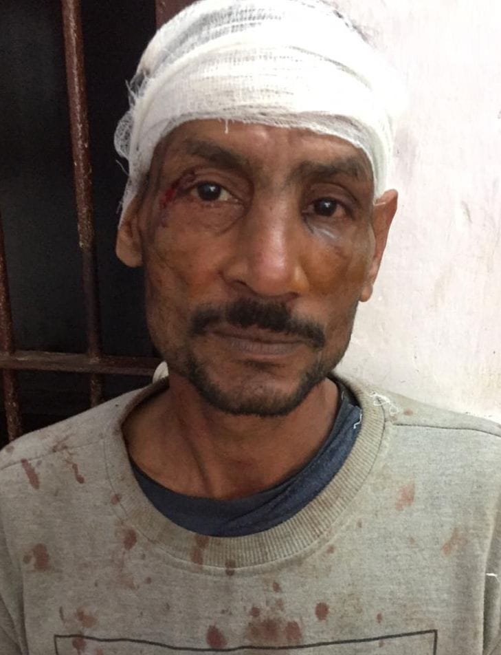 four injured due to soil put in way, stone peltering