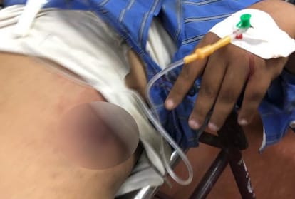 goons shot a travels operator, injured in lucknow