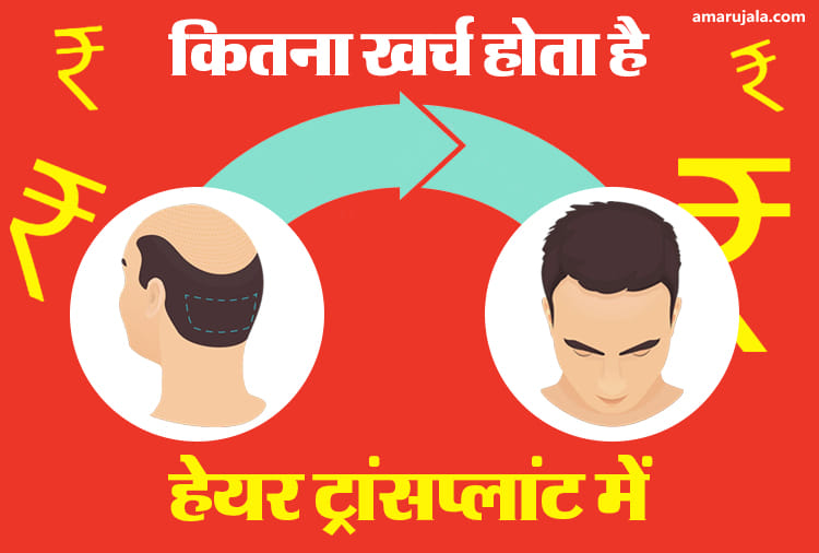 कितना खर्चा आता है इस ट्रीटमेंट में