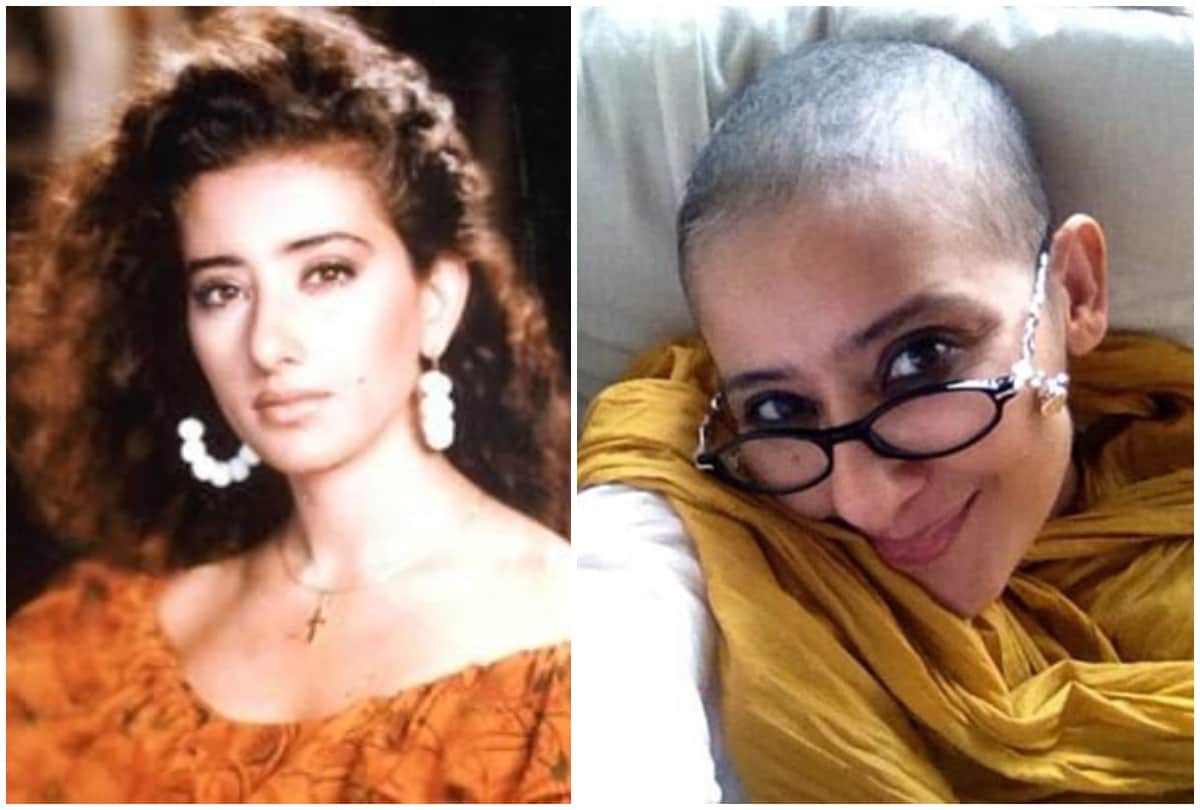 Then and Now Manisha Koirala shared picture during cancer treatment huge transformation in looks