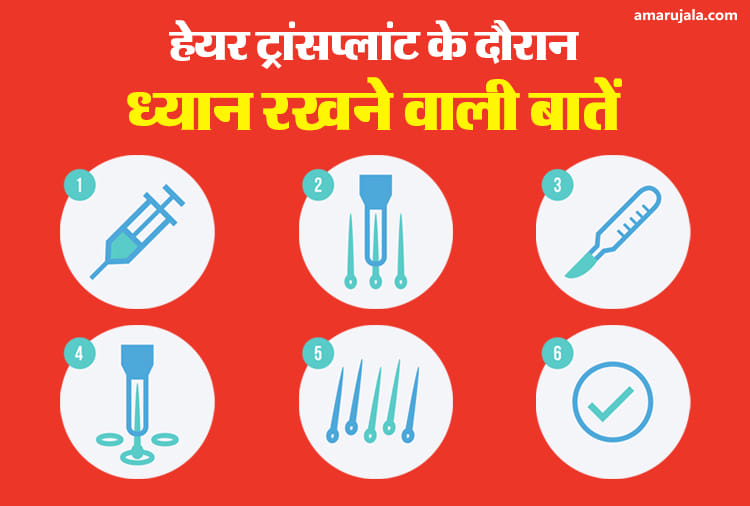 हेयर ट्रांसप्लांट के दौरान ध्यान रखने वाली बातें