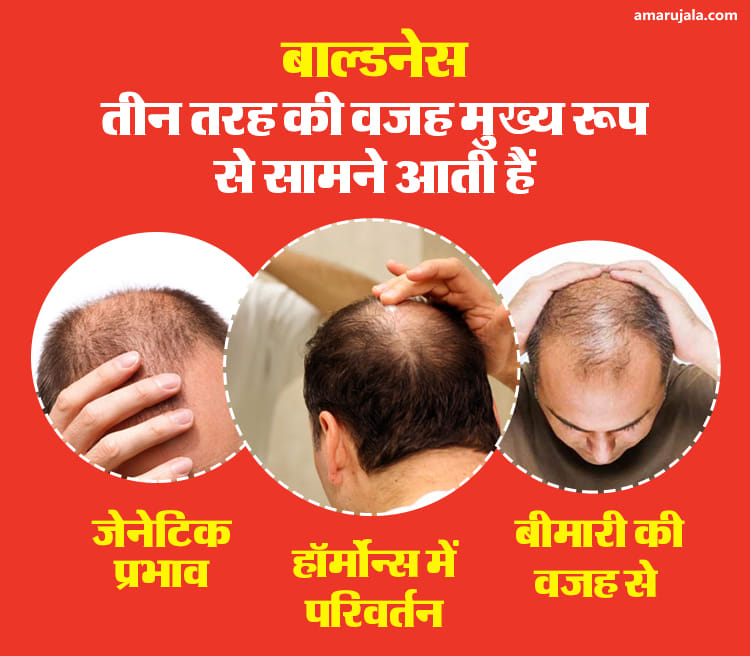 हेयर ट्रांसप्लांट (फाइल फोटो)