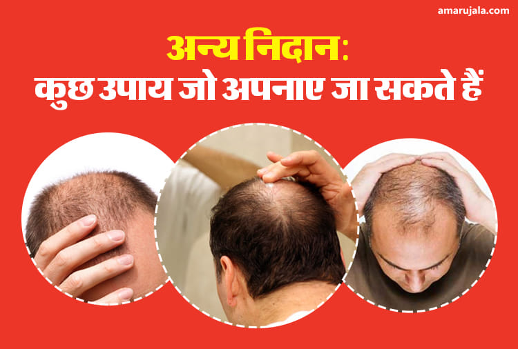 हेयर ट्रांसप्लांट या  हेयर ग्राफ्टिंग