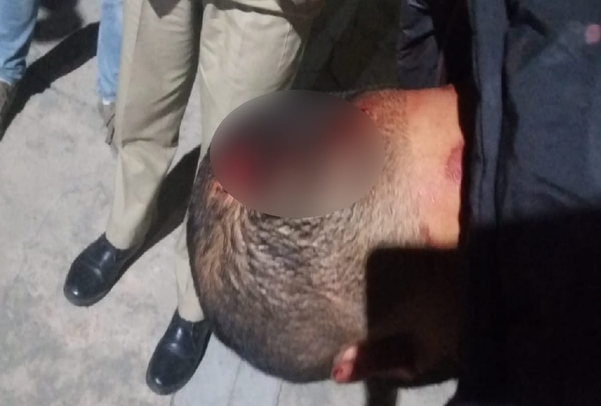 Students clash outside this college in Shimla, many bled