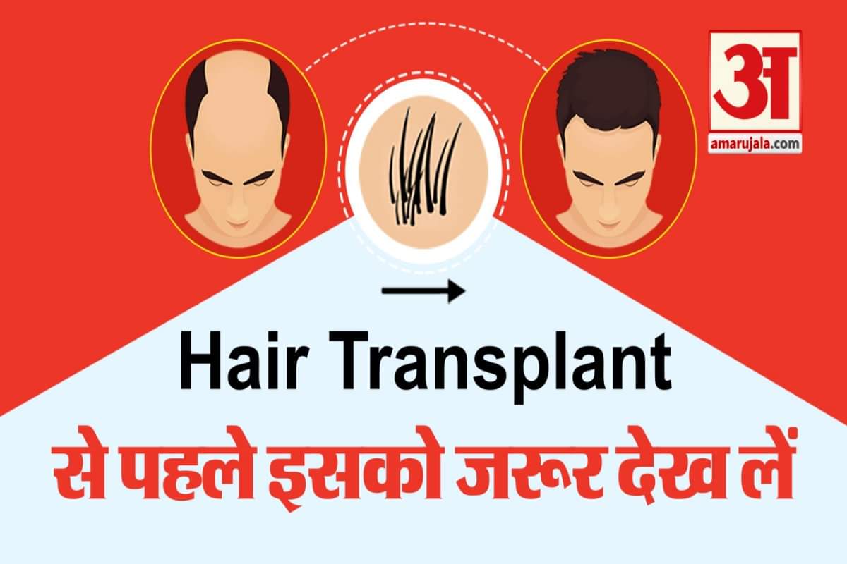 हेयर ट्रांसप्लांट