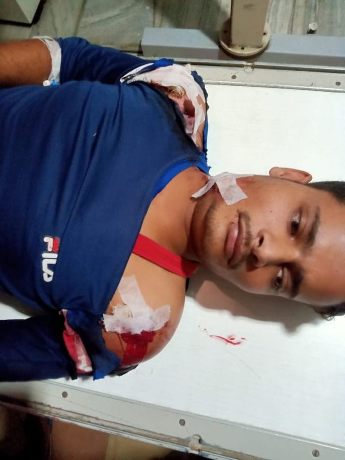 Unsuccessful miscreants shot the operator of the Customer Service Center, Varanasi Refer