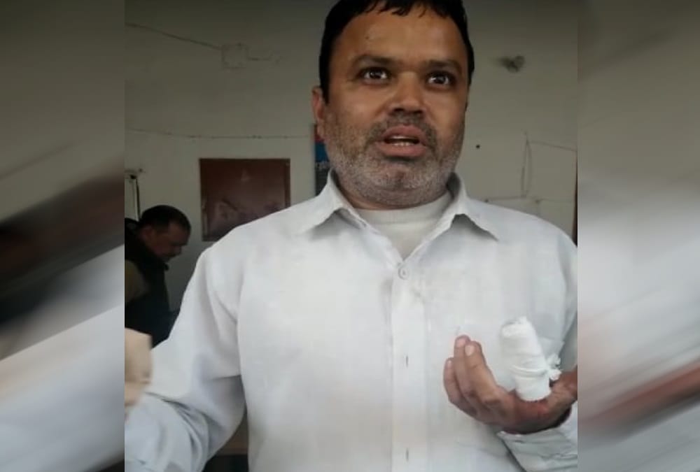 Youth Ruckus and Cut Congress leader Finger by mouth during Cheap onion selling in haldwani