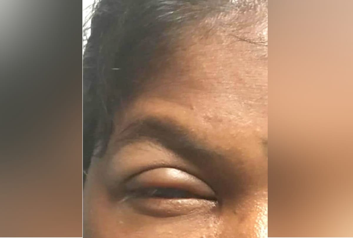 delhi unknown man chemical attack on woman at ajmeri gate now absconding probe on