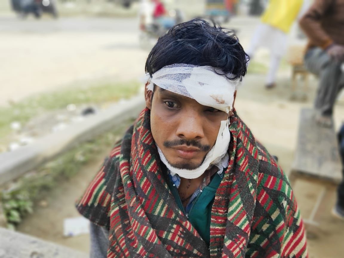 husband injured by wife