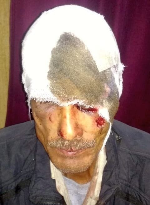 Dhan Singh of Pangarpani clashed with a bear