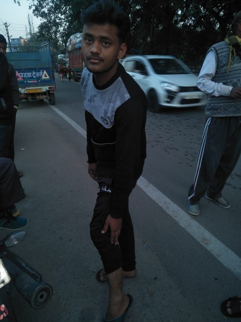 11 people were bitten by dogs in Ramnagar