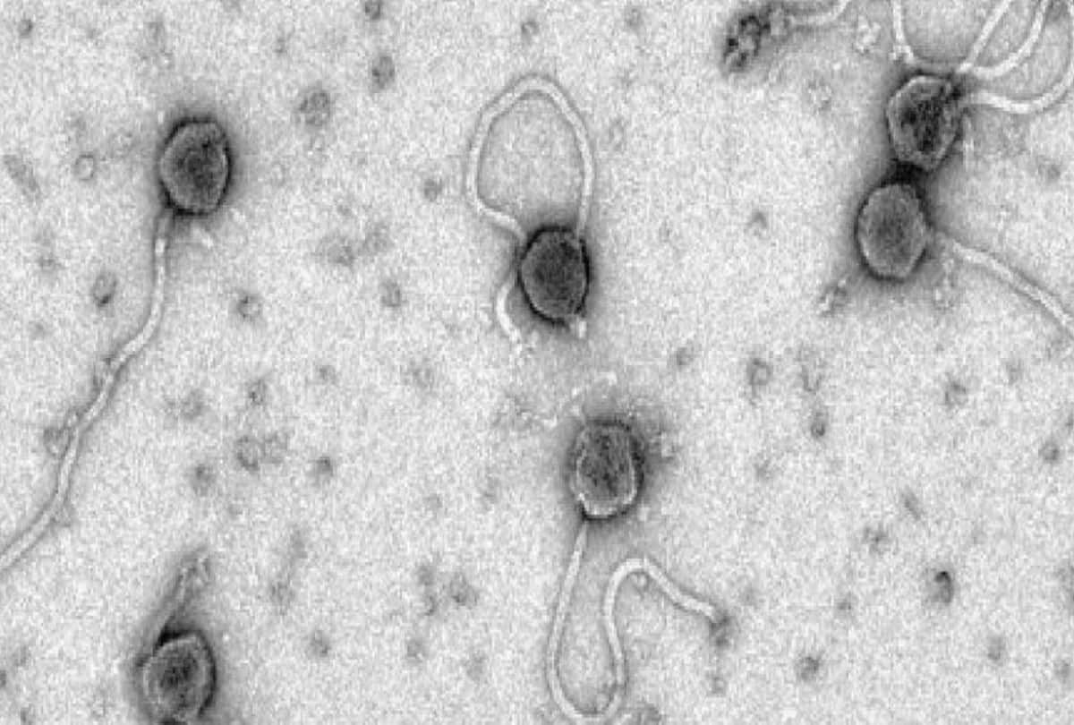 Will warmer weather stop the spread of the coronavirus ends in summer season