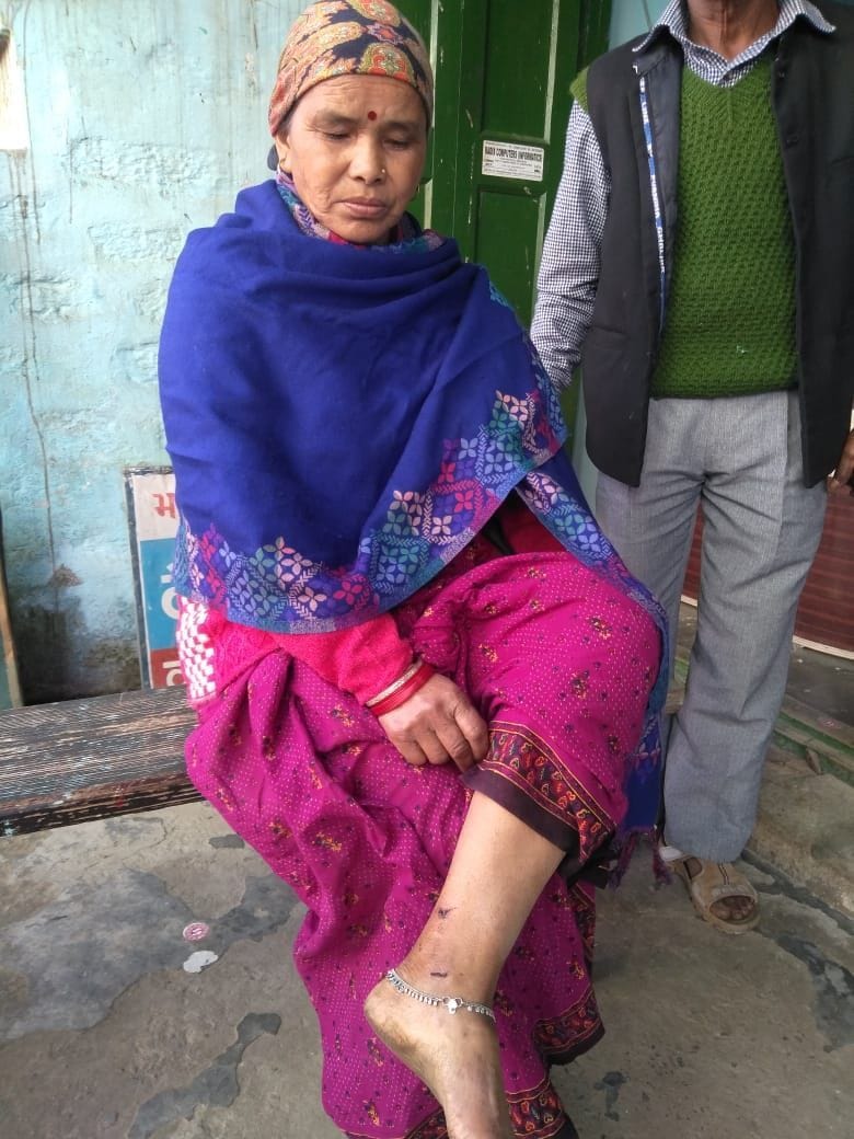 leopard ran out due to bravery of woman