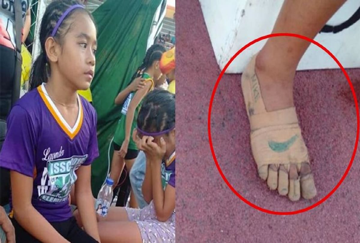 11 year old girl wins three gold medals with just bandages on her feet in Philippines