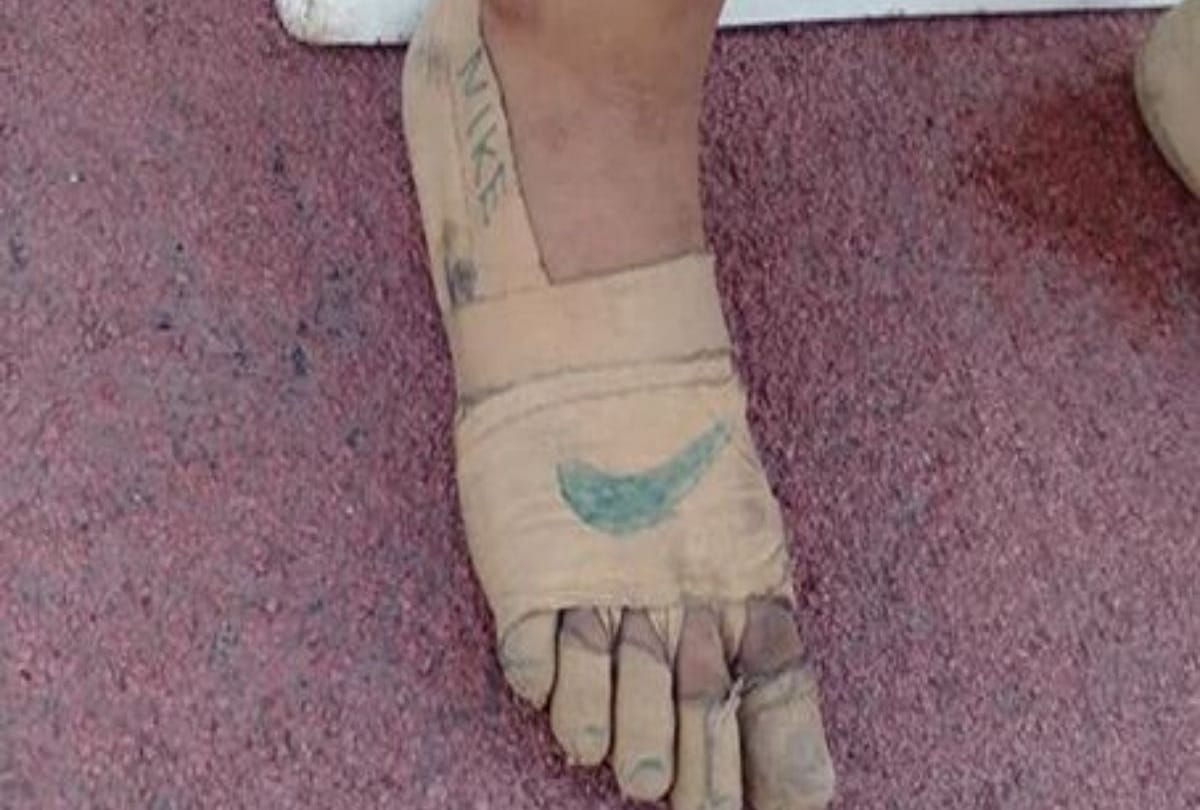 11 year old girl wins three gold medals with just bandages on her feet in Philippines