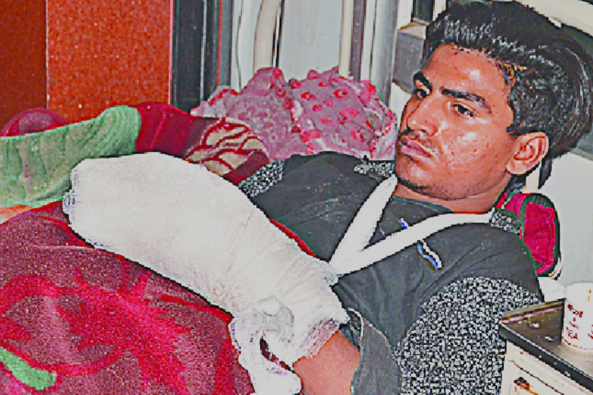 Meerut bawal, injured people told the real story of firing and fire CAA protest
