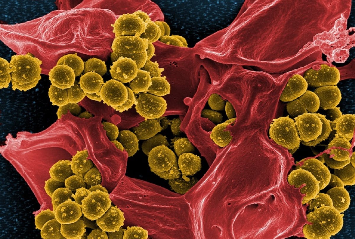 bacterial outbreak in China after covid 19 which infected more than three thousand people