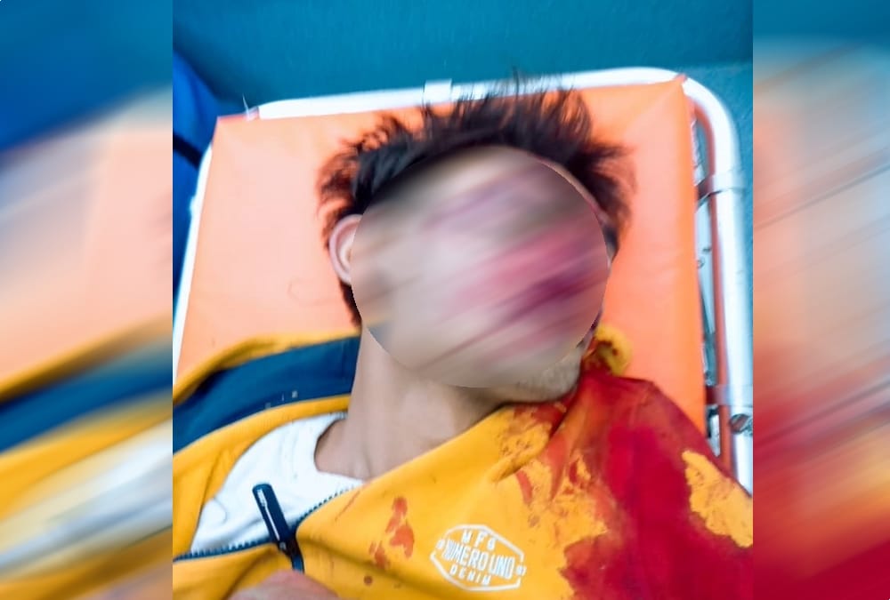 Two Friends Killed and one Badly Injured during Car fell into ditch in tehri Photos