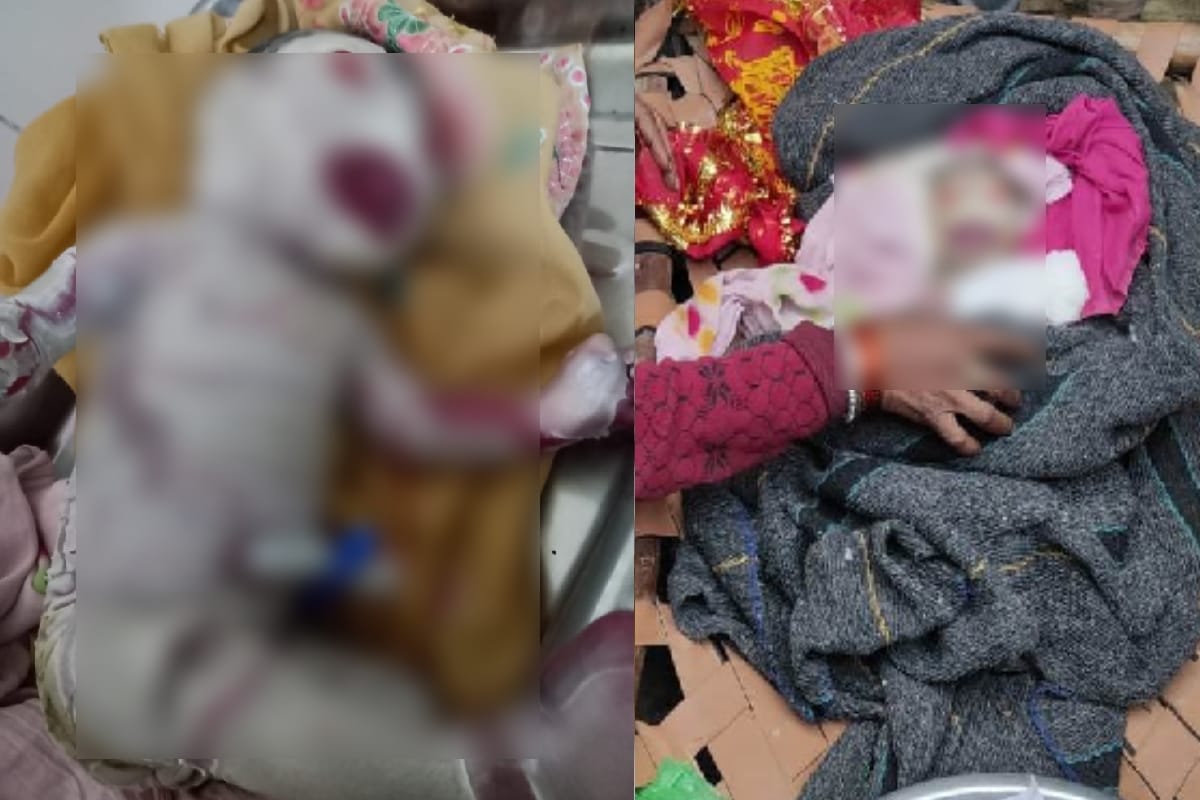 Harlequin baby born to Meerut woman, Harlequin Ichthyosis a rare genetic skin disorder