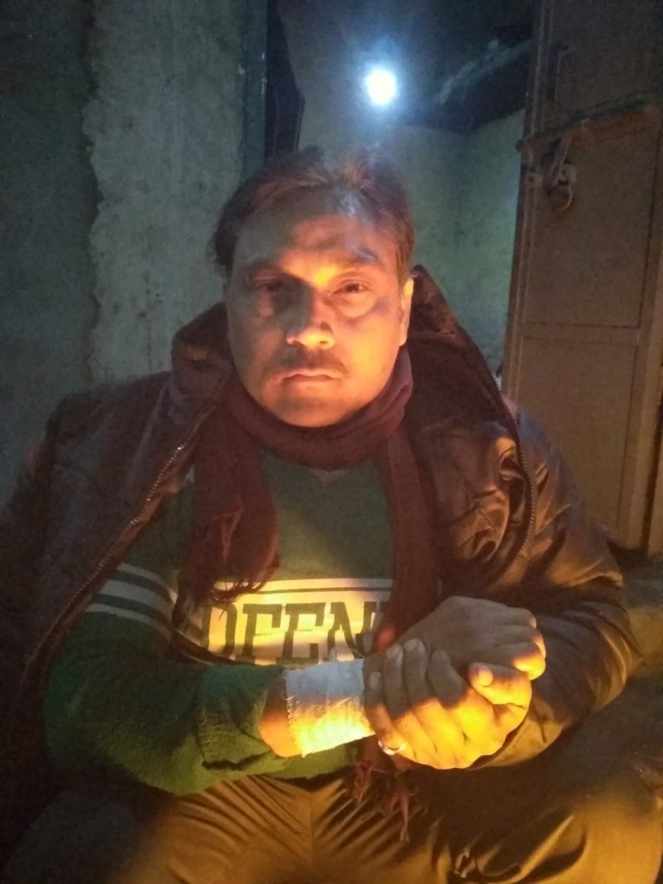 mental monkey bite in mathura