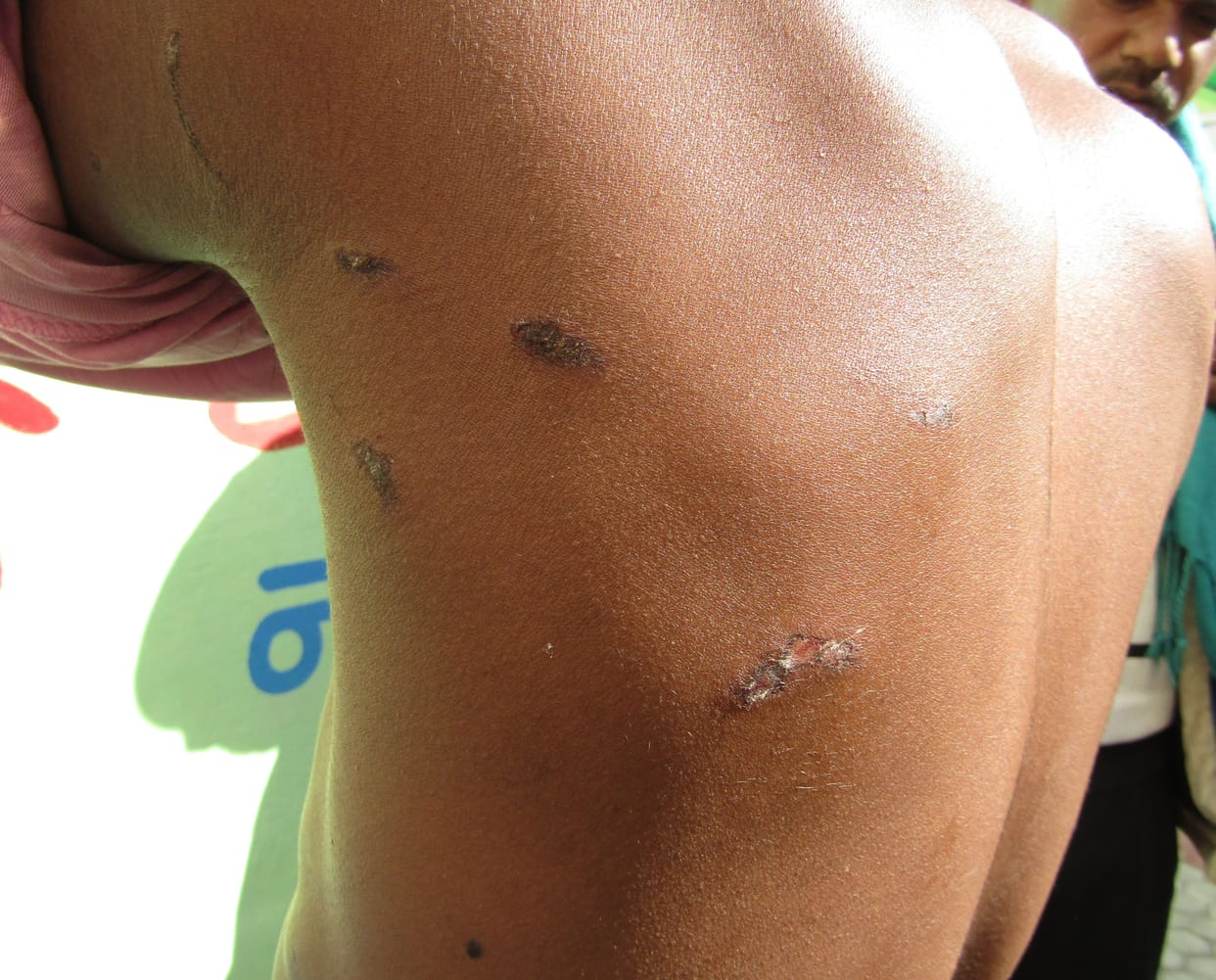 Leopard attacked the student who went to the forest