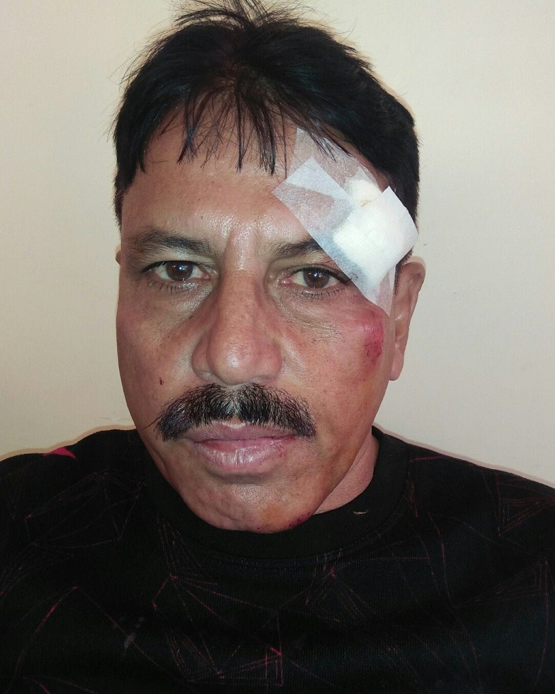 Two injured