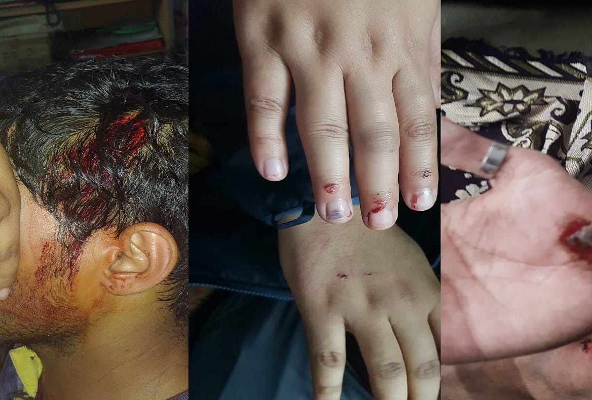two groups fight In JNU student union president and female teacher Head cracked