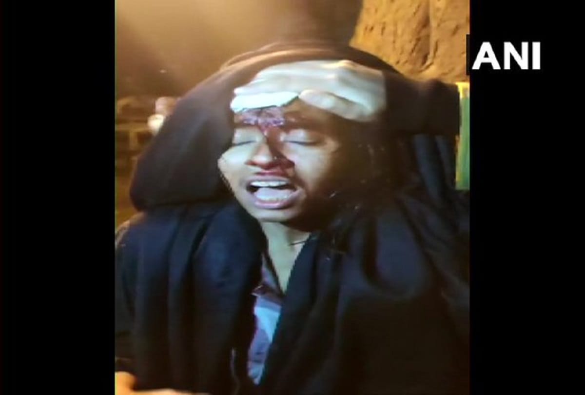 two groups fight In JNU student union president and female teacher Head cracked