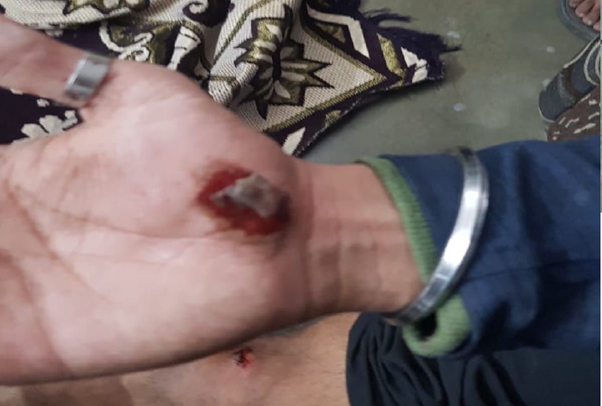 two groups fight In JNU student union president and female teacher Head cracked
