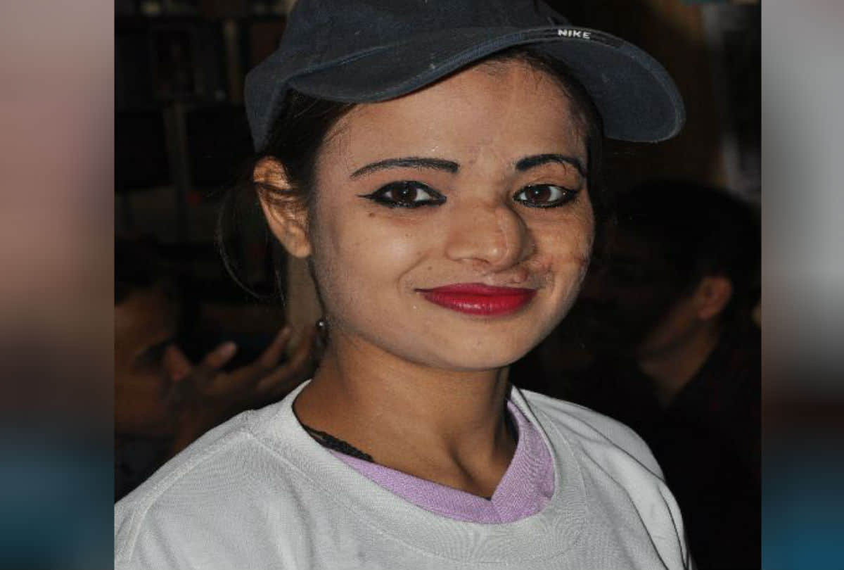 Real Story Of Acid Attack Brave Girls Chhapaak Film