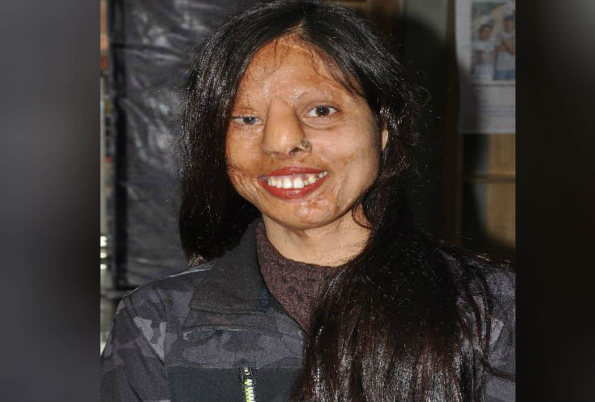 Real Story Of Acid Attack Brave Girls Chhapaak Film