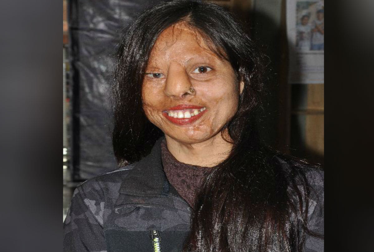 Real Story Of Acid Attack Brave Girls Chhapaak Film