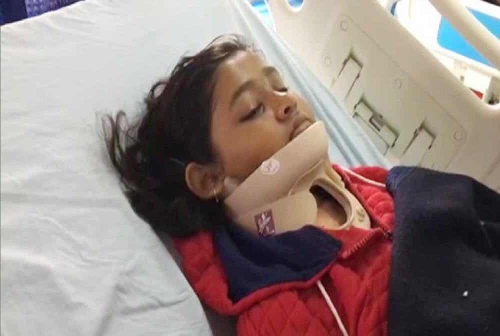 Practice before 3D technology then did operation of archer Shivangini