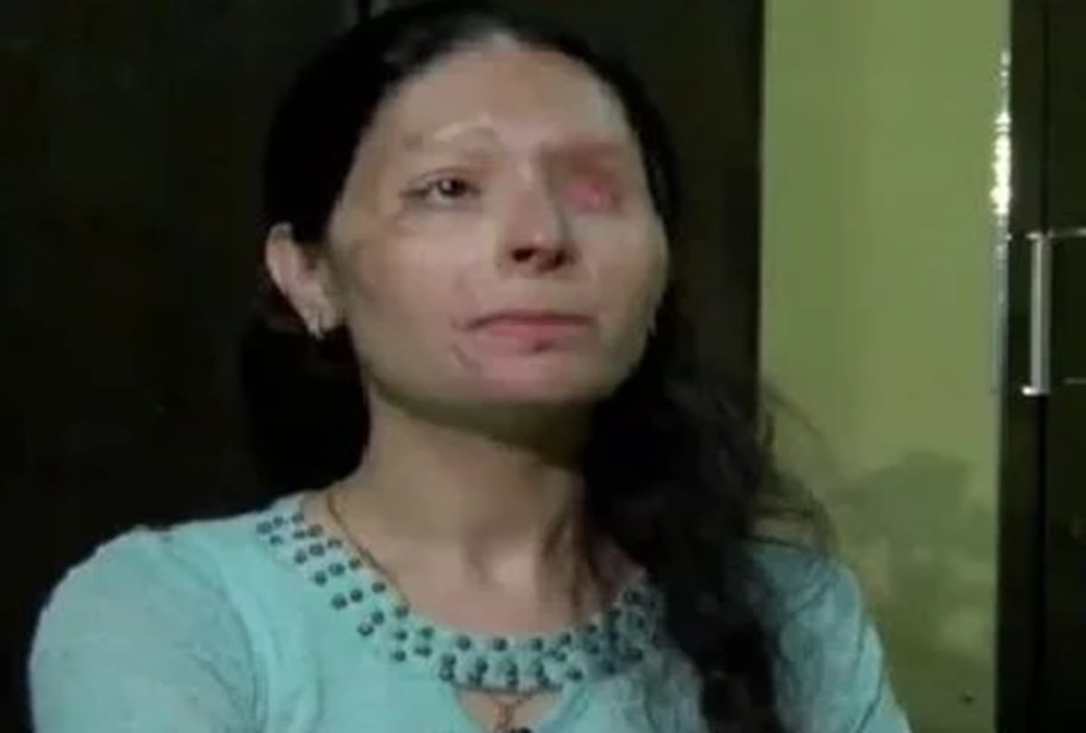 A splash here too: Reshma Qureshi of Prayagraj became the voice of acid victims
