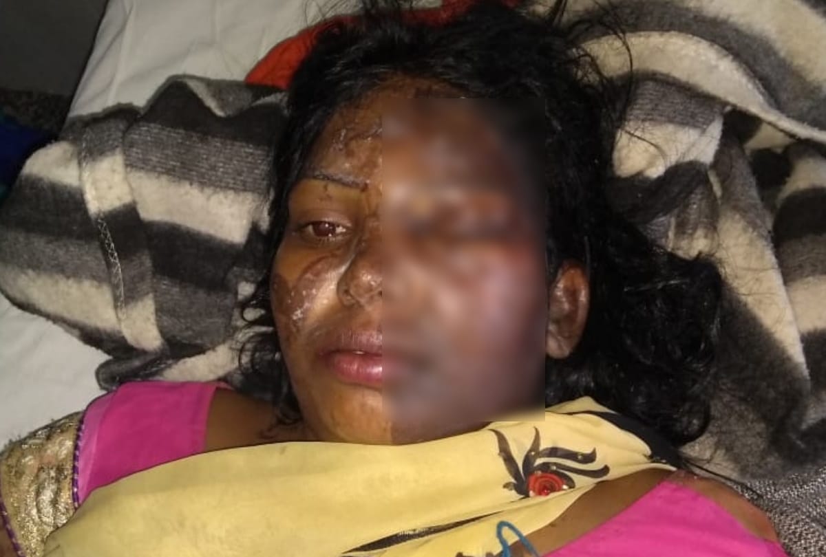 new disclousement in acid incident at gorakhpur, victim woman given new statement