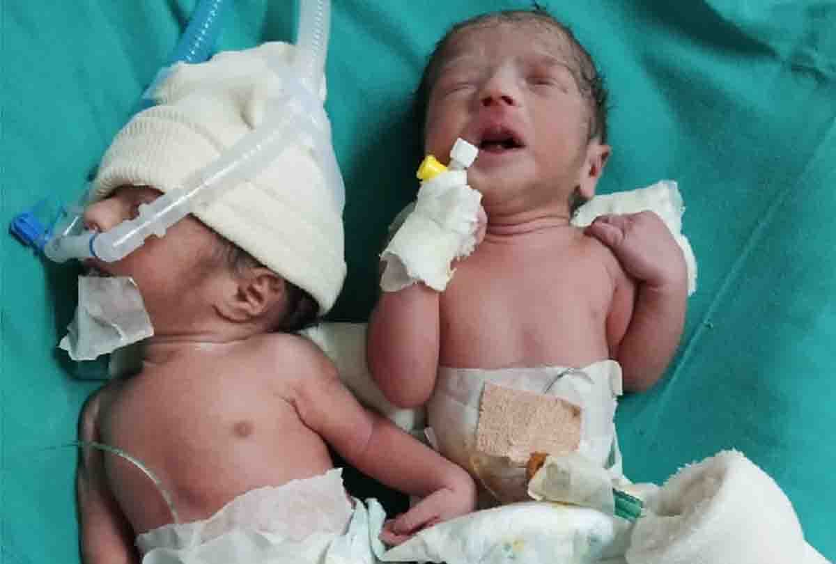 50 year old woman gave birth to twins in jammu kashmir