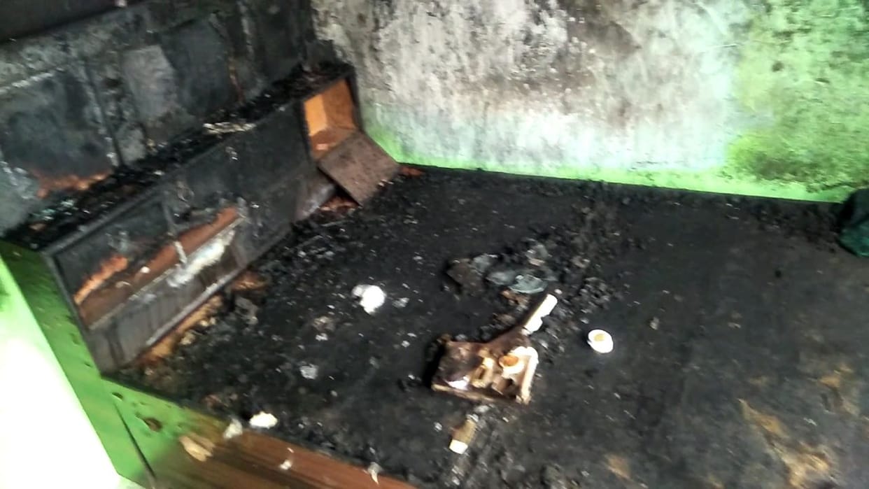 new couple scorched by the fire in the  room , 80 % scorched, pgi refer