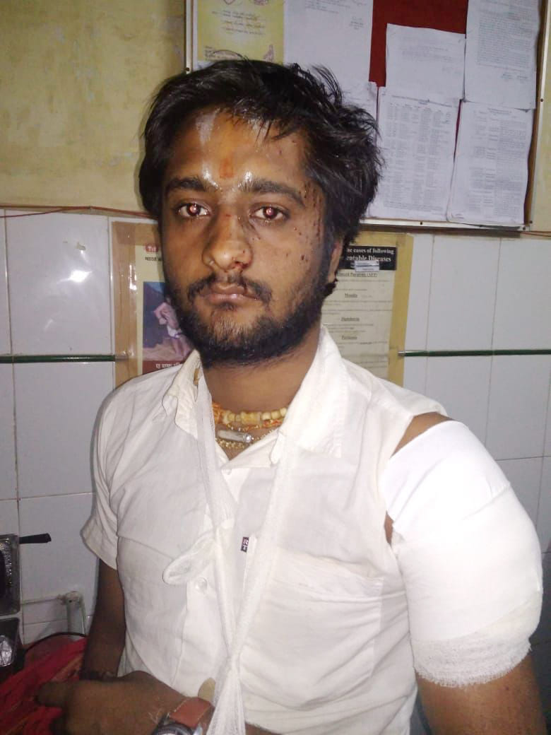 Chitrakoot: A needle of suspicion turned towards the injured disciple of Mahant
