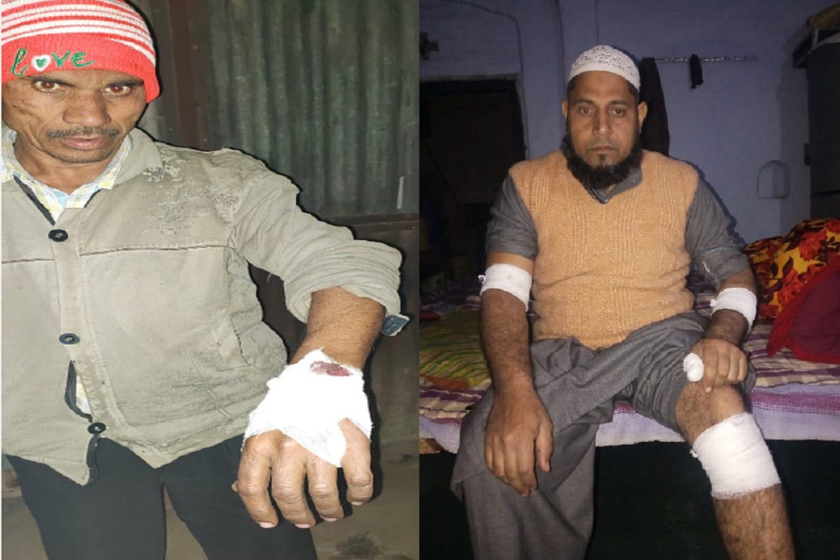 Dog attacked on fifty peoples in Tanda village of Baghpat city