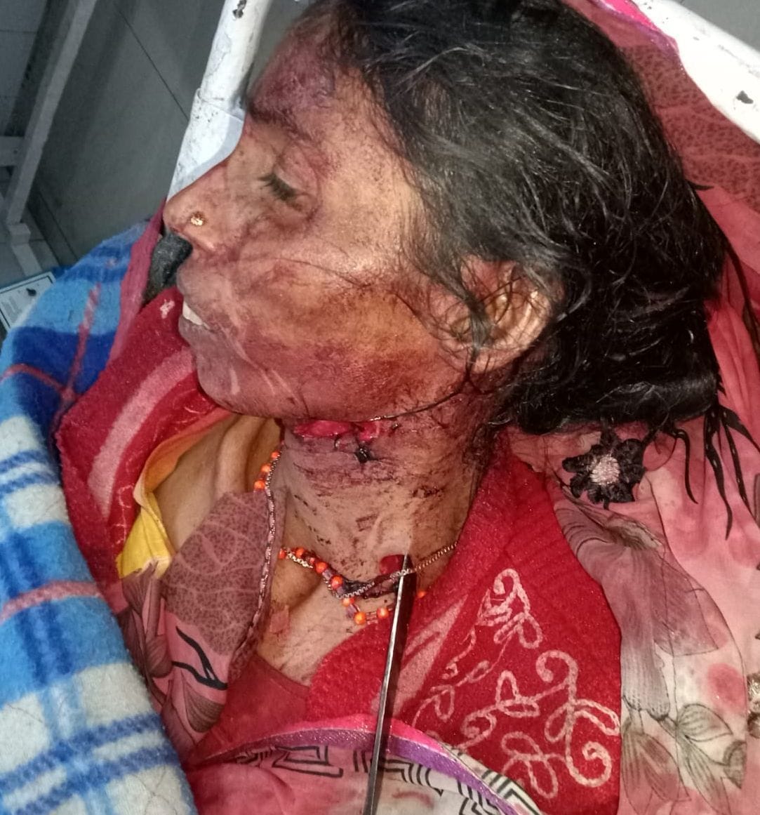 attack from woman, daranti stuk in neck