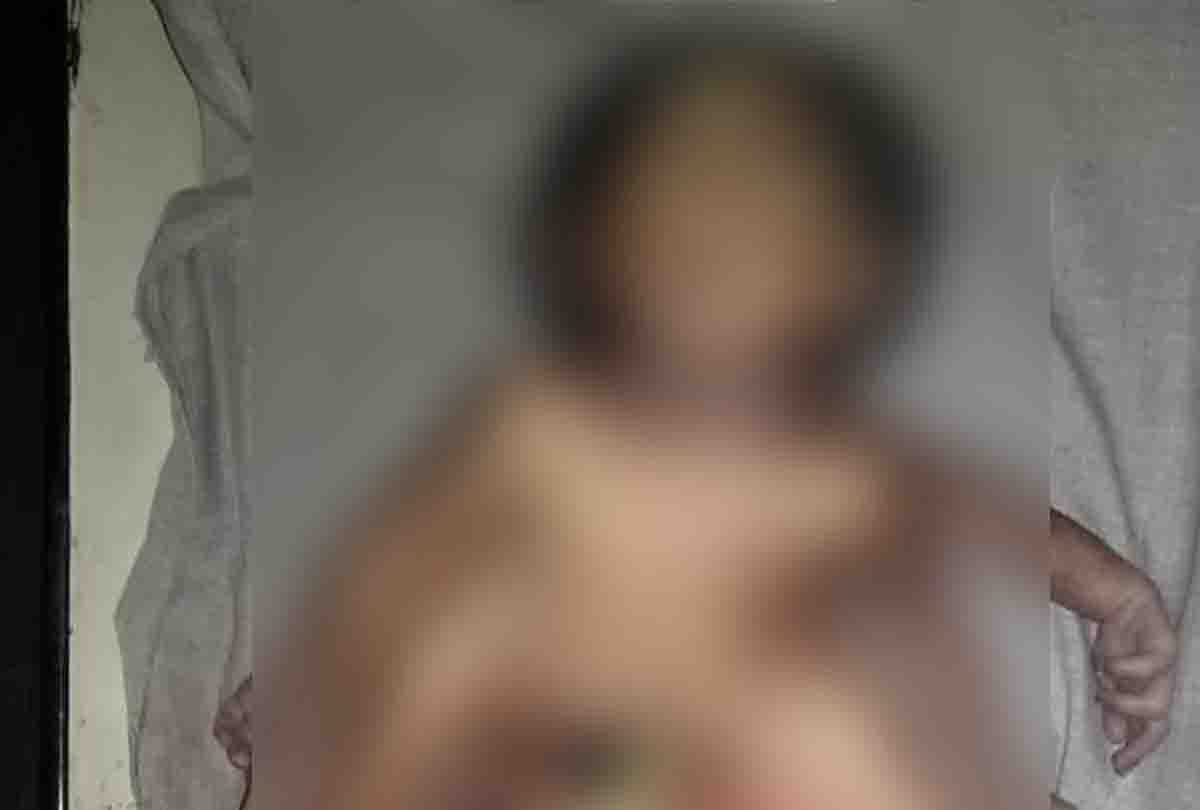 Four-legged and hand baby born in Auraiya