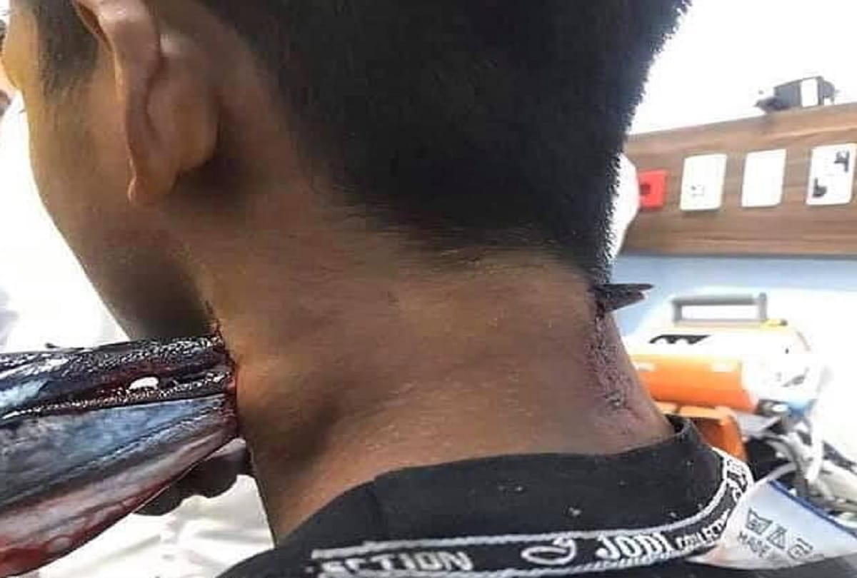 needlefish jumped out the water and stabbed a boy neck in Indonesia