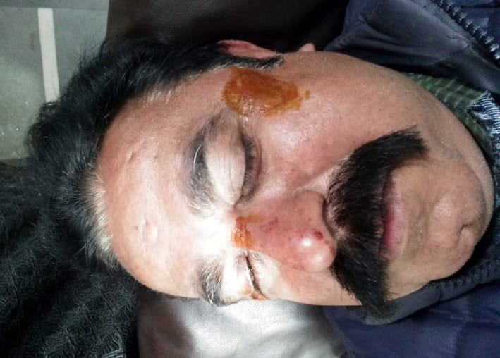 Two more injured including a young man from Chinese